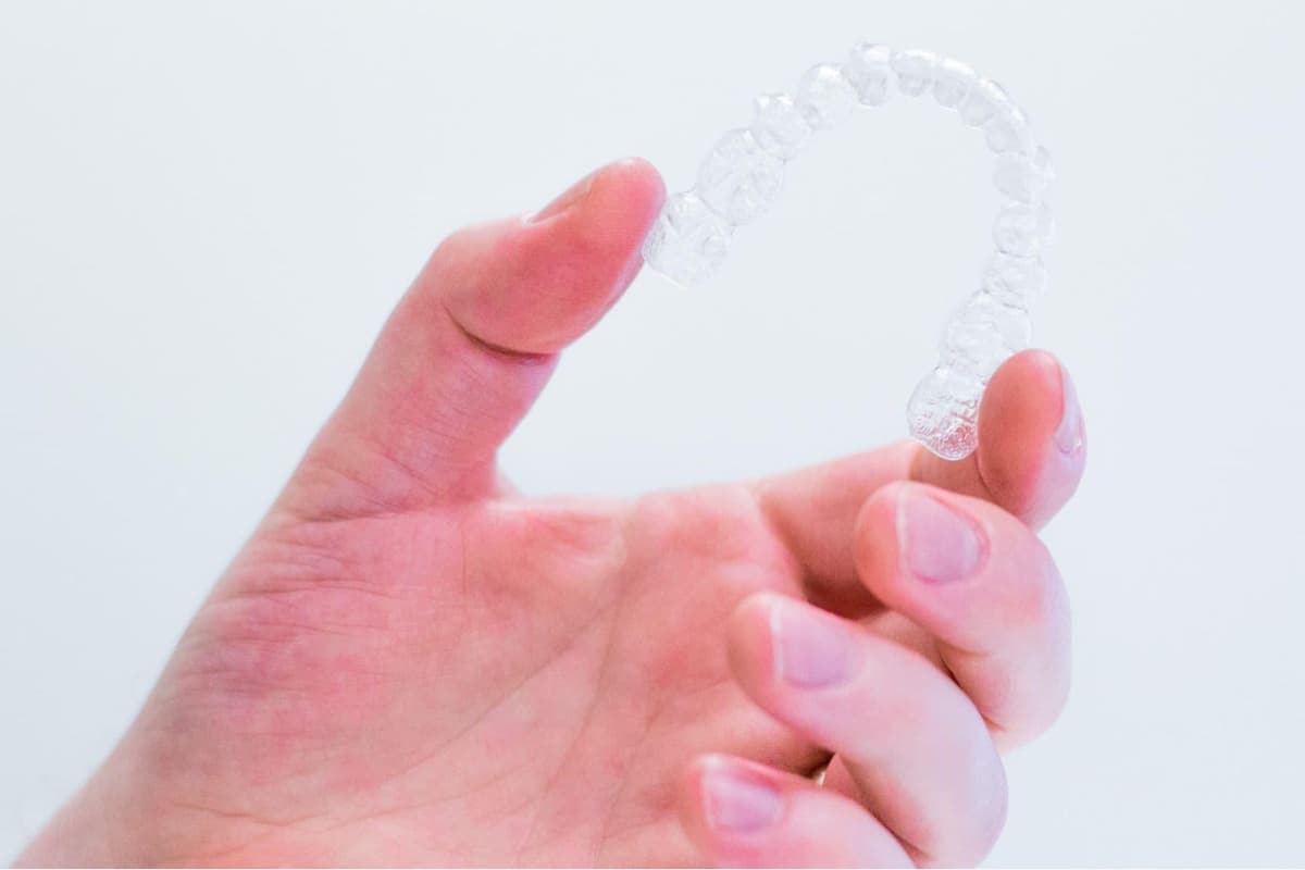 Clear Aligners Treatment